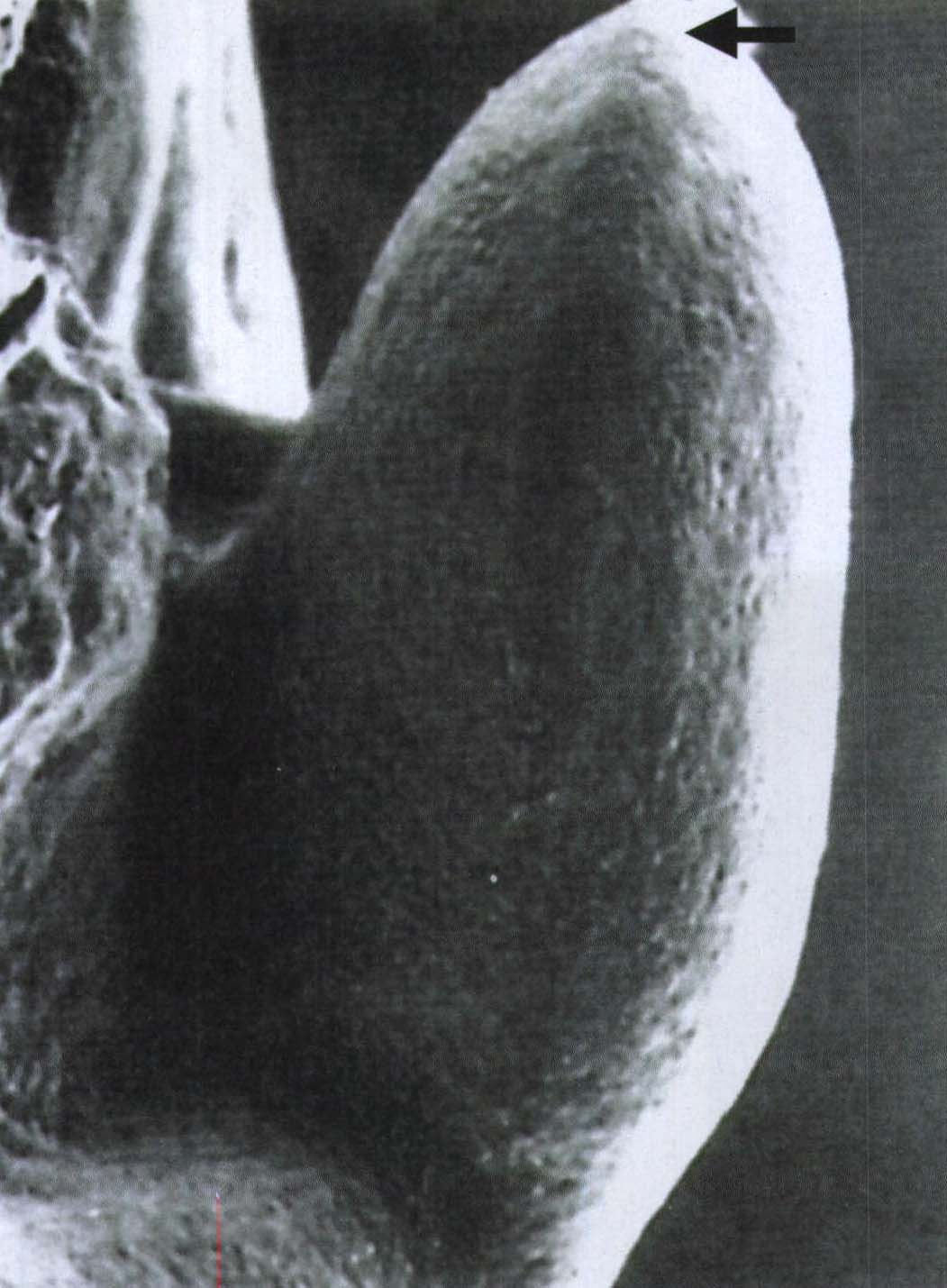 图1-3 外胚层顶嵴的外形